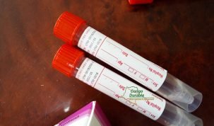 Le coronavirus